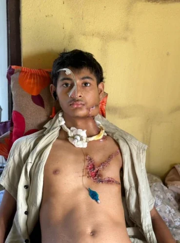 Shantanu - During the treatment in Biratnagar. Image via SHantanu. Used with permission.