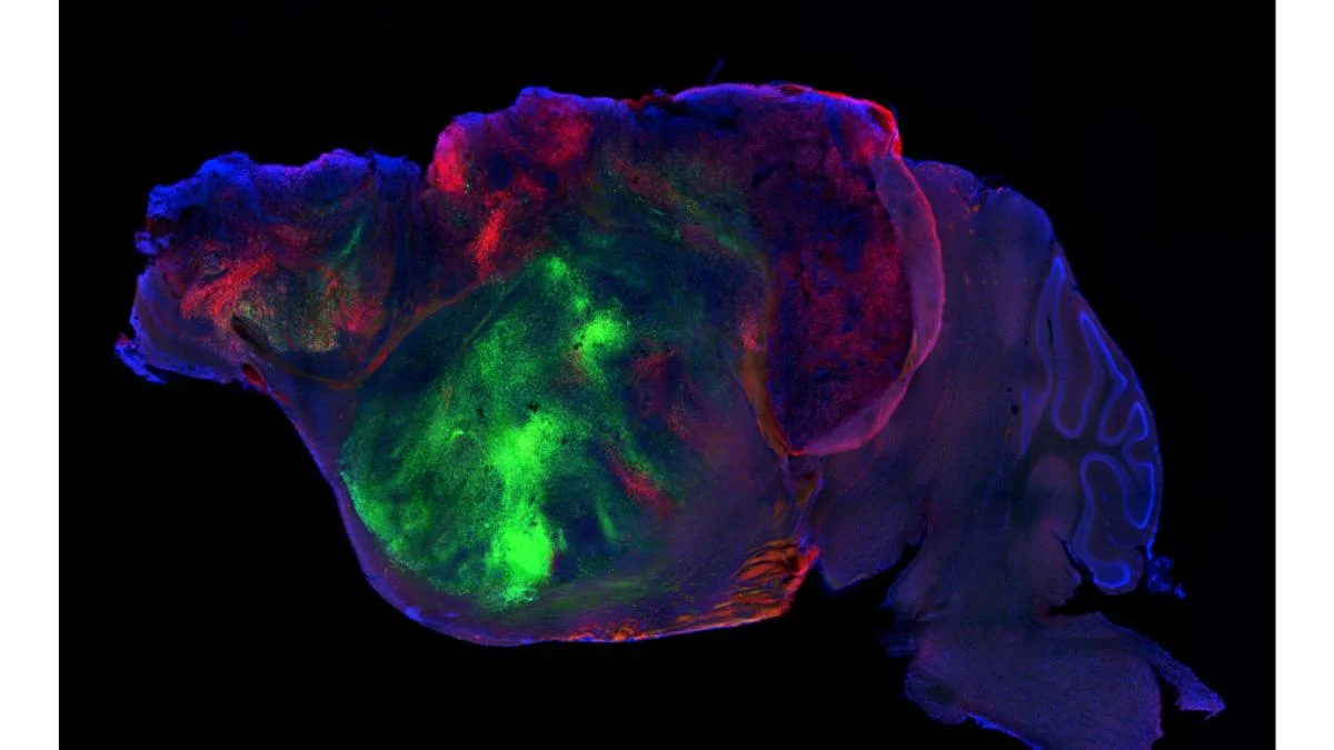 Avance en el Estudio del Cerebro: Organoides Humanos Implantados en Ratones